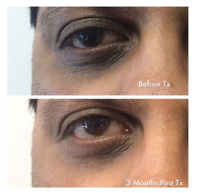 RETINOL REBOOT EYE CREAM